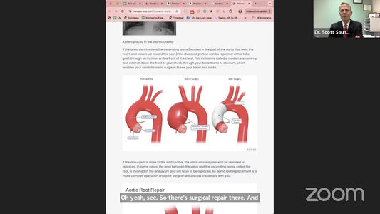 Most common symptoms of a heart attack